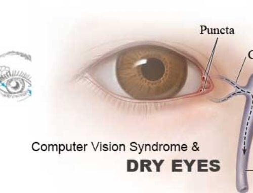 Dry Eyes Treatment