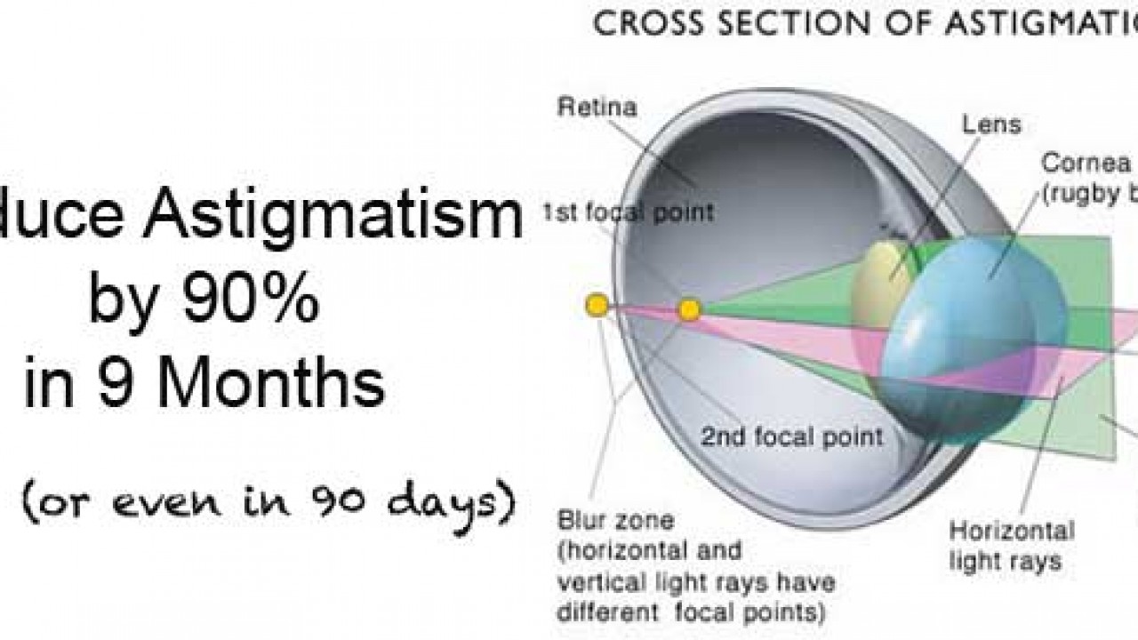 astigmatism ridicat al miopiei